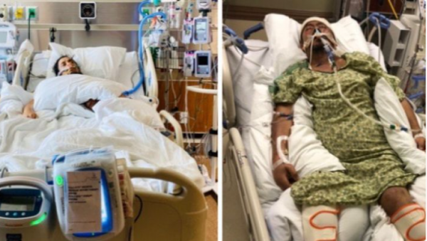 Nepali in Texas suffers brain hemorrhage at workplace, still unconscious after 18 days