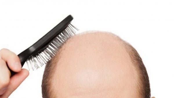 Newly married wife lodged a lawsuit against her bald husband