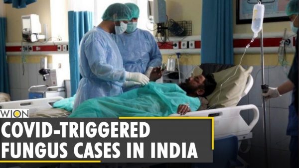 New threat of mucormycosis post COVID-19 in India